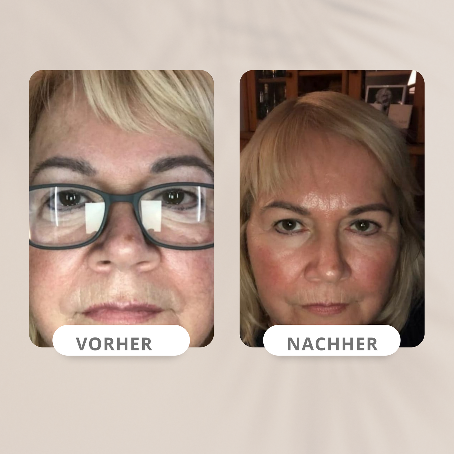 Produkte gegen die Hautalterung
